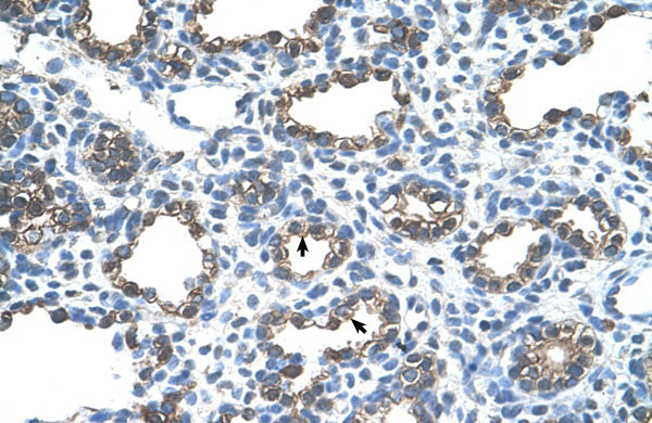 2 - ANK1 antibody - C-terminal region AI12117