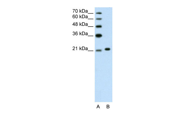1 - ANK1 antibody - C-terminal region AI12117