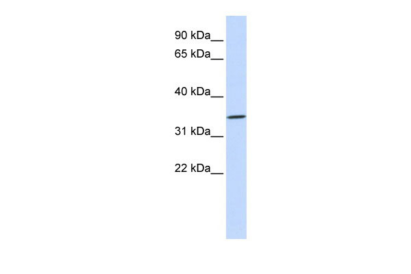 1 - RHCE antibody - N-terminal region AI12118