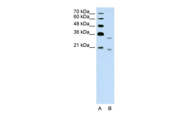 1 - DNASE2B antibody - C-terminal region AI12124