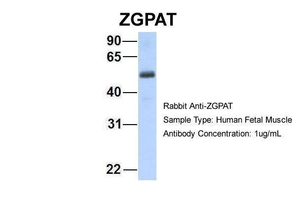 1 - ZGPAT antibody - C-terminal region AI12140