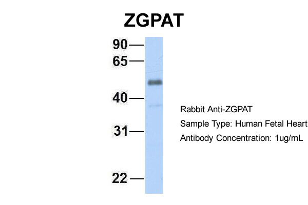 1 - ZGPAT antibody - C-terminal region AI12140