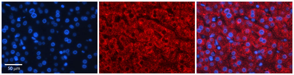 2 - GAMT antibody - middle region AI12141