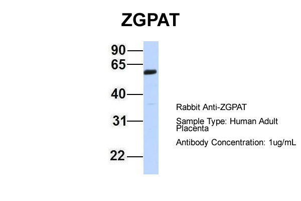 1 - ZGPAT antibody - middle region AI12144