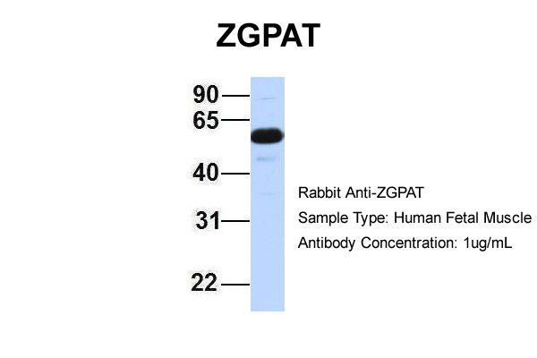 1 - ZGPAT antibody - middle region AI12144