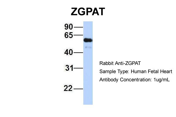 1 - ZGPAT antibody - middle region AI12144