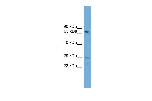 1 - Rgs18 antibody - N-terminal region AI12168