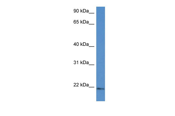 1 - Ube2g1 antibody - N-terminal region AI12205