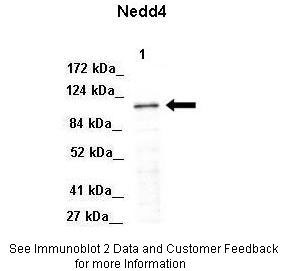 1 - NEDD4 antibody - middle region AI12213
