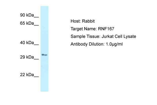 1 - RNF167 Antibody - C-terminal region AI12233