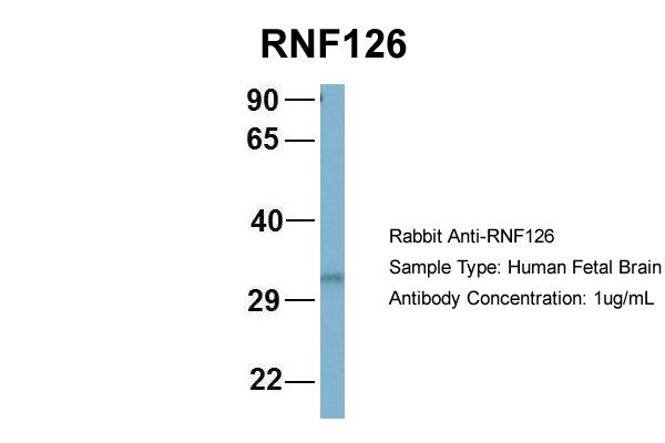 1 - RNF126 antibody - N-terminal region AI12242