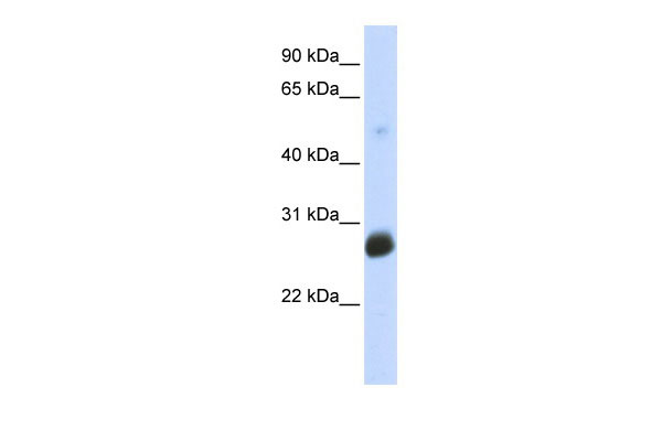 1 - RNF186 antibody - middle region AI12249