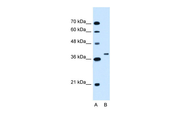 1 - RNF146 antibody - C-terminal region AI12266