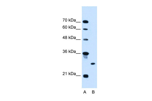1 - RNF39 antibody - C-terminal region AI12278