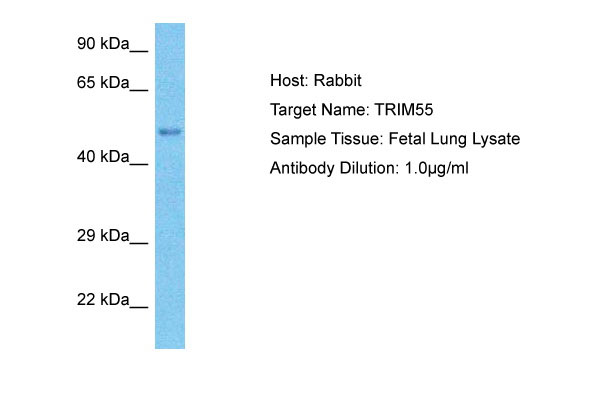 1 - TRI55 Antibody - middle region AI12283