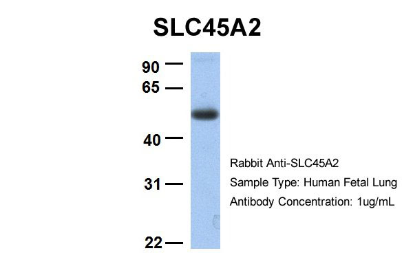 1 - SLC45A2 antibody - C-terminal region AI12320