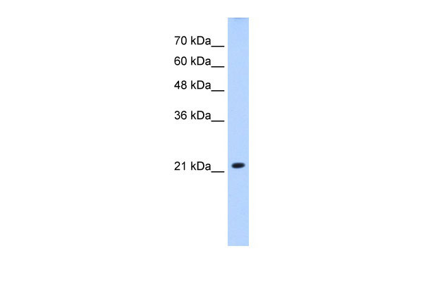 1 - SLC25A14 antibody - N-terminal region AI12336