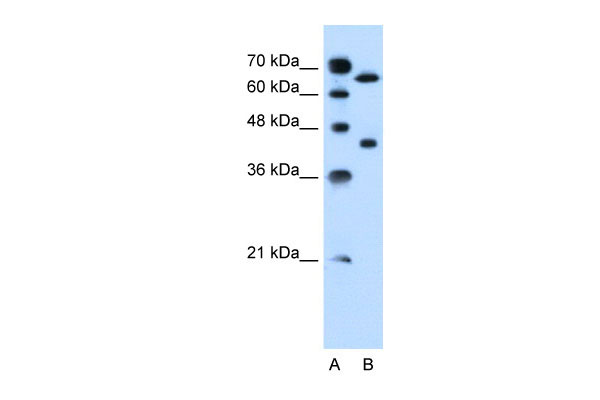 1 - SLCO1A2 antibody - middle region AI12345