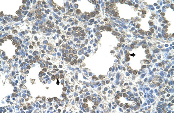 2 - SLC26A5 antibody - middle region AI12387