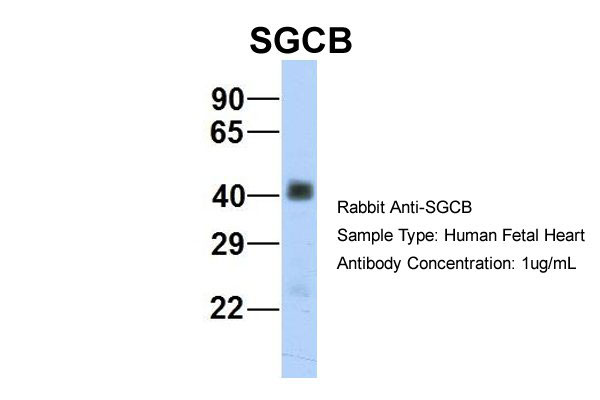 1 - SGCB antibody - middle region AI12393