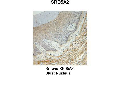 2 - SRD5A2 antibody - N-terminal region AI12399