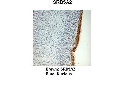 2 - SRD5A2 antibody - N-terminal region AI12399