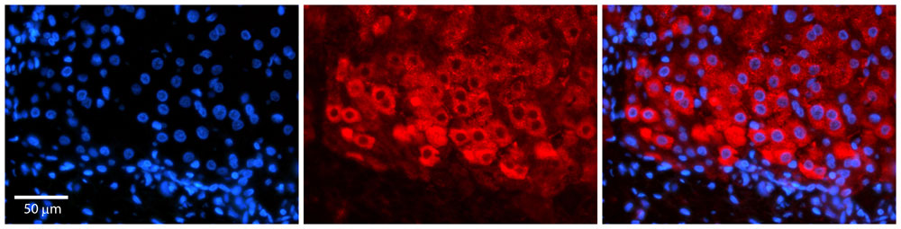 2 - CSF1 antibody - N-terminal region AI12408