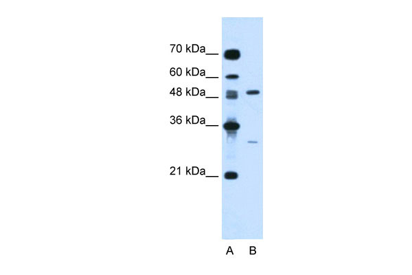 1 - CSF1 antibody - N-terminal region AI12408