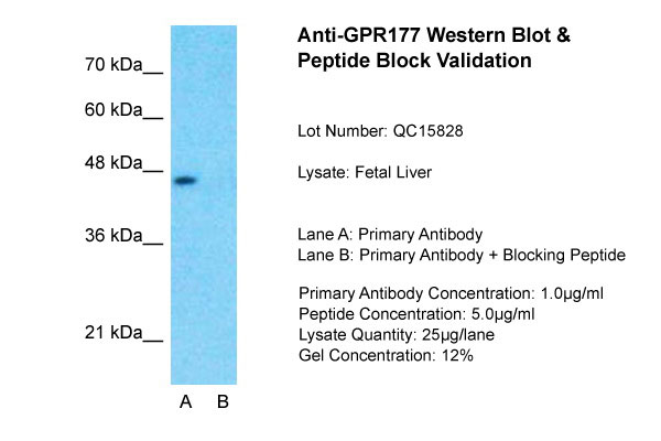 1 - GPR177 antibody - N-terminal region AI12420