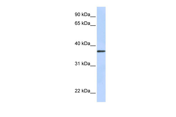 1 - TTMB antibody - N-terminal region AI12425