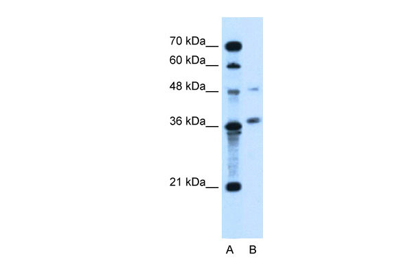 1 - ARMCX6 antibody - N-terminal region AI12452