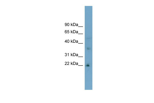 1 - LDLRAD1 antibody - middle region AI12456