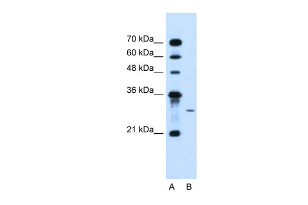 1 - AGPAT2 antibody - C-terminal region AI12464