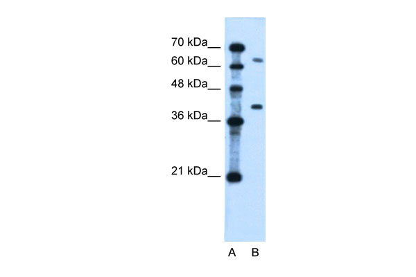 1 - LRRC26 antibody - middle region AI12474