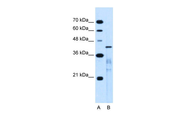 1 - MARVELD3 antibody - middle region AI12483