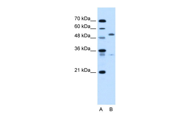 1 - PODXL antibody - N-terminal region AI12485