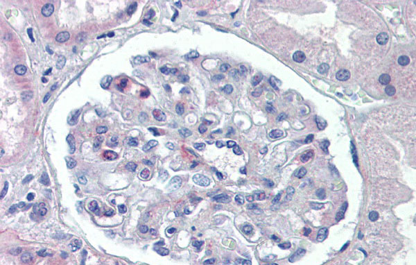 2 - PODXL antibody - middle region AI12486