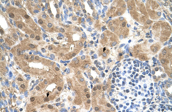 2 - MGC39633 antibody - N-terminal region AI12524