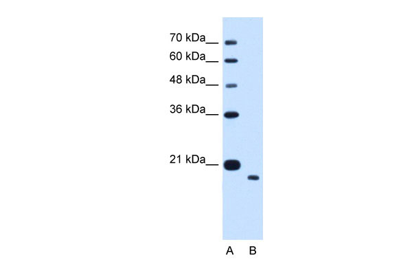 1 - TMEM91 antibody - N-terminal region AI12526