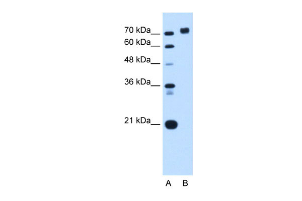 1 - PTPRN antibody - middle region AI12569
