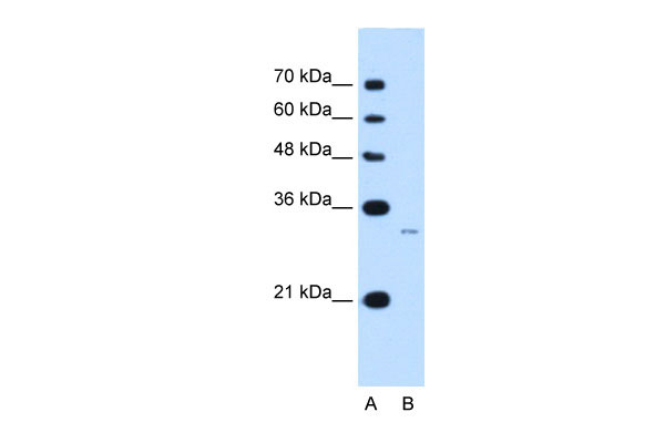 1 - MUC3B antibody - N-terminal region AI12589