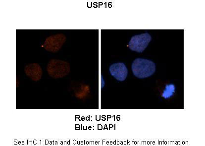 2 - USP16 antibody - N-terminal region AI12621