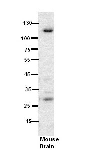 1 - N6AMT1 antibody - N-terminal region AI12628