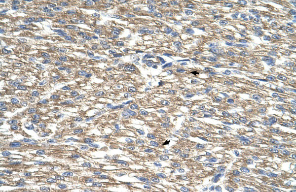 2 - TCP10L antibody - middle region AI12634