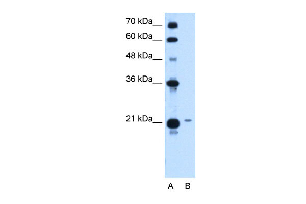 1 - TCP10L antibody - middle region AI12634