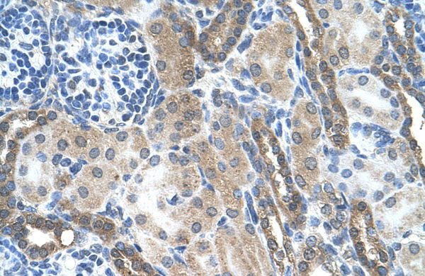 2 - LOC728227 antibody - C-terminal region AI12637