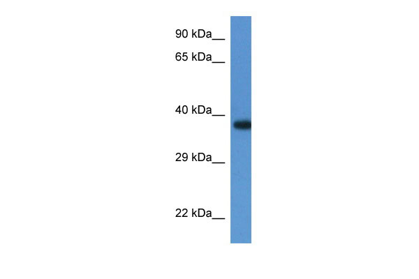 1 - LOC100047915 antibody - N-terminal region AI12638