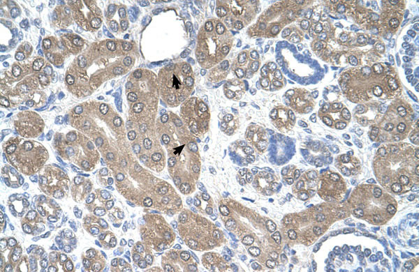 2 - ST3GAL5 antibody - N-terminal region AI12675