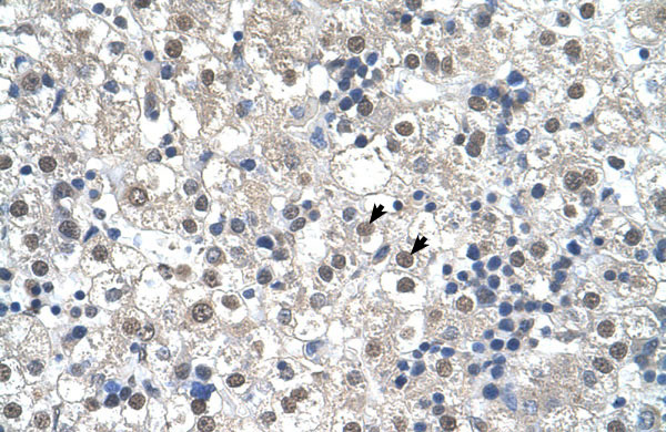 2 - RTN2 antibody - N-terminal region AI12700
