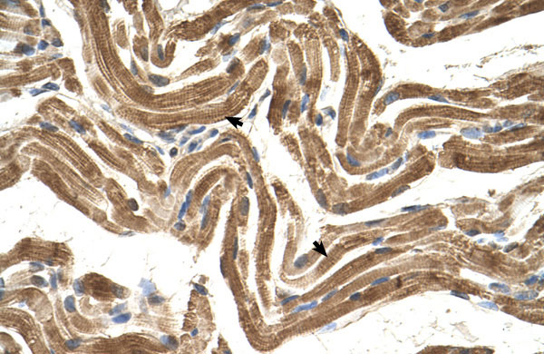 2 - FICD antibody - C-terminal region AI12719